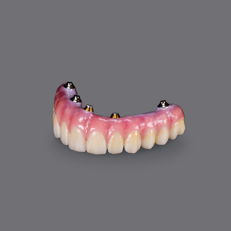 Fixed Price Implant Solutions