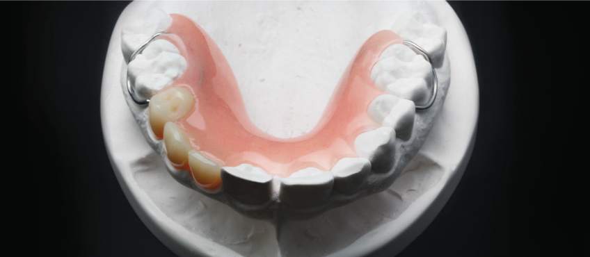 partial denture